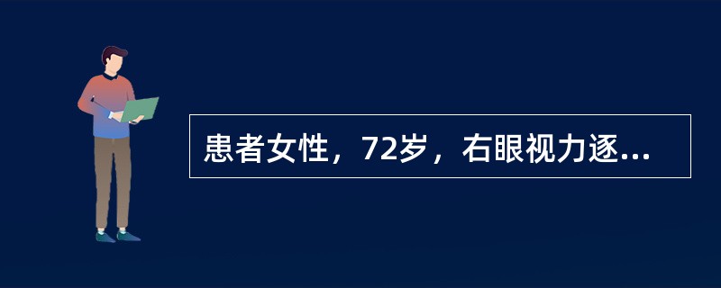 患者女性，72岁，右眼视力逐渐下降6年，眼部检查：视力：右指数／40cm，左0．