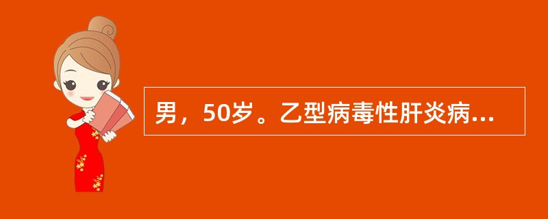 男，50岁。乙型病毒性肝炎病史30年，腹胀，乏力，双下肢水肿伴尿少1个月。B超检