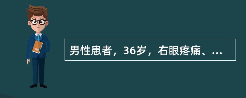 男性患者，36岁，右眼疼痛、畏光、流泪及视力下降1个月，诊断为“蚕蚀性角膜溃疡”