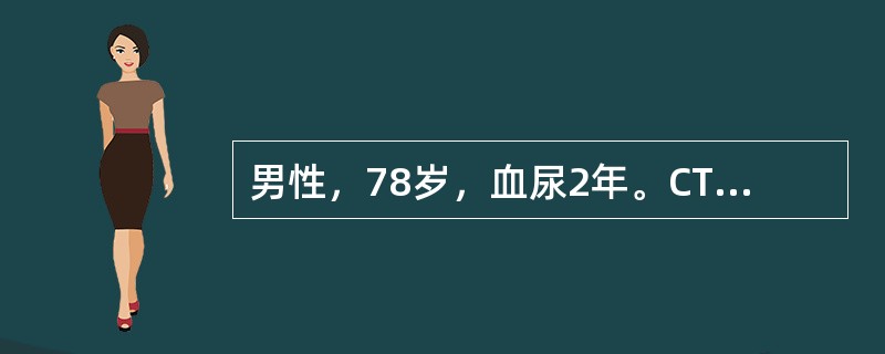 男性，78岁，血尿2年。CT示右侧肾盂内可见软组织密度影，肾盂肾盏受压变形，考虑