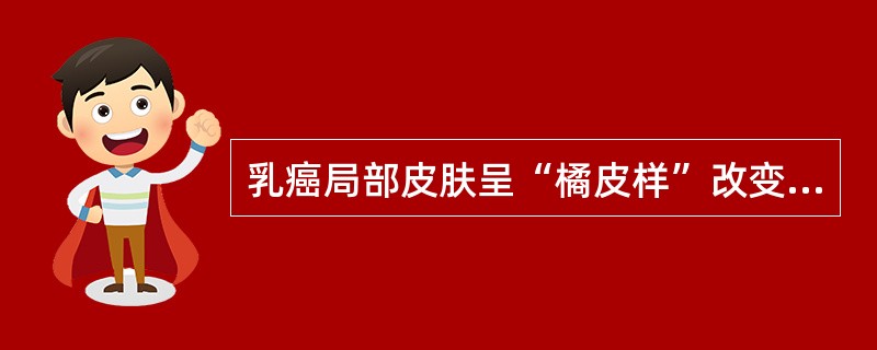 乳癌局部皮肤呈“橘皮样”改变的原因是（）。