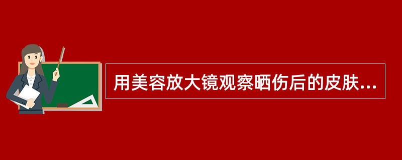 用美容放大镜观察晒伤后的皮肤，发现（）增厚、毛孔扩大。