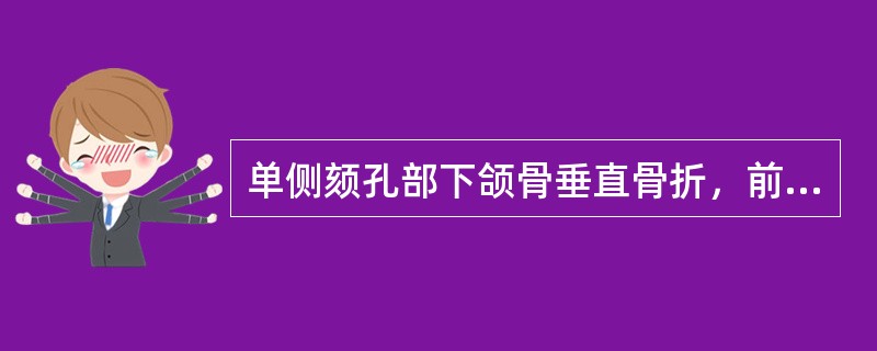 单侧颏孔部下颌骨垂直骨折，前段骨折片向下后方移位并微偏患侧是由于（）