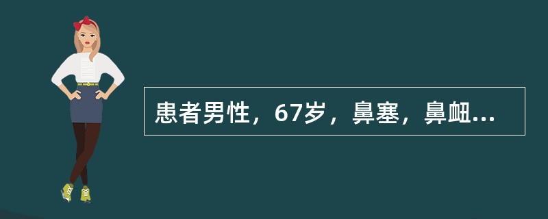 患者男性，67岁，鼻塞，鼻衄8个月，鼻腔镜见鼻咽顶部黏膜粗糙，触之易出血。病理活