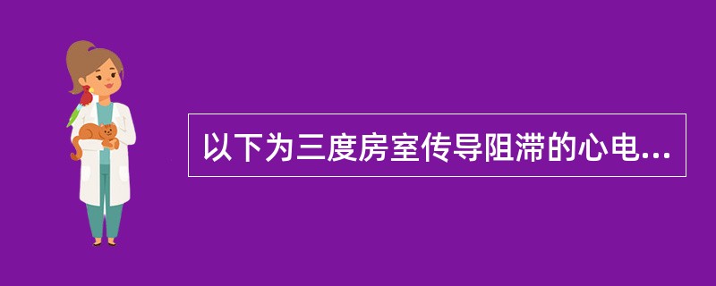 以下为三度房室传导阻滞的心电图表现，但应除外