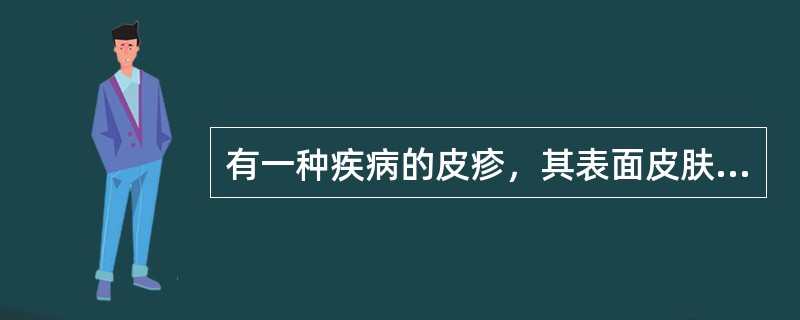 有一种疾病的皮疹，其表面皮肤发红，主要分布在小腿伸侧面的结节，不破溃，压之疼痛。