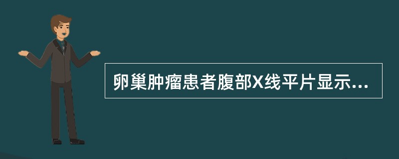 卵巢肿瘤患者腹部X线平片显示牙齿或骨骼，最可能的诊断是（）