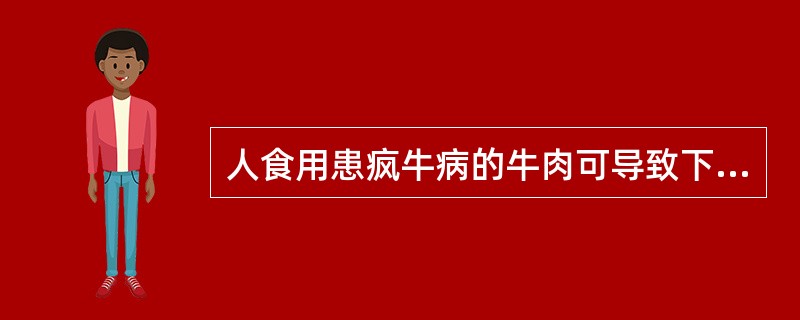 人食用患疯牛病的牛肉可导致下列哪种疾病()