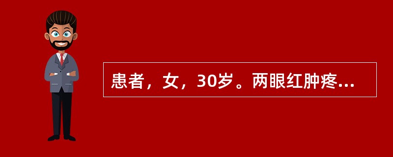 患者，女，30岁。两眼红肿疼痛5天，眵多，畏光，流泪，口苦，烦热，便秘，舌红，苔