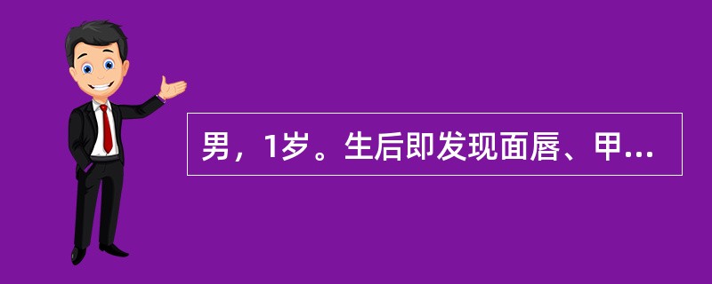 男，1岁。生后即发现面唇、甲床发绀，哭吵时加重，心前区闻及Ⅲ级收缩期杂音，P减弱