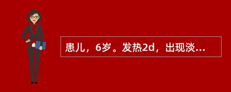 患儿，6岁。发热2d，出现淡红色小丘疹，根盘红晕，丘疹上部可见疱疹，形态椭圆，胞