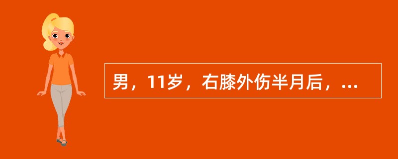 男，11岁，右膝外伤半月后，疼痛，活动受限，高烧5天。右胫骨上端明显深压痛，为明