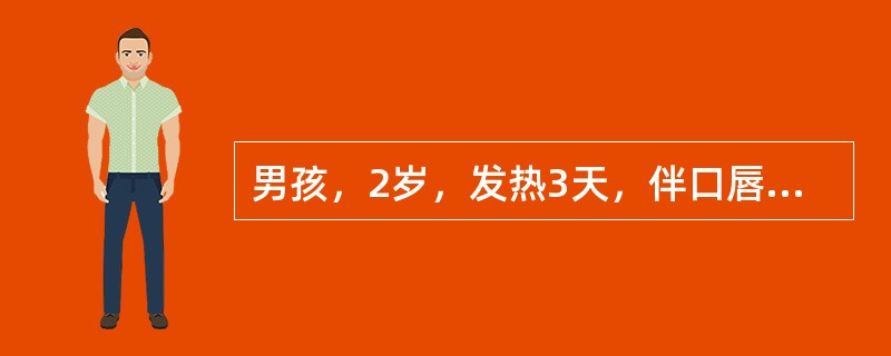 男孩，2岁，发热3天，伴口唇稍红，发热时双眼球结膜轻度充血，咽部可见均匀稀薄白色