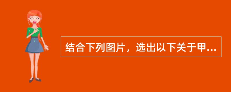 结合下列图片，选出以下关于甲状腺解剖说法正确的是（）