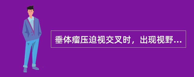 垂体瘤压迫视交叉时，出现视野缺损，最常见的症状是（）。