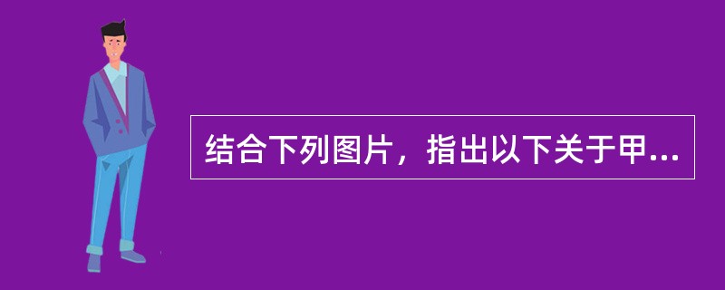 结合下列图片，指出以下关于甲状腺的说法正确的是()