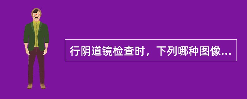 行阴道镜检查时，下列哪种图像属于正常子宫颈上皮（）