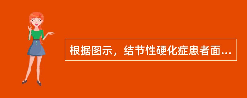 根据图示，结节性硬化症患者面部的典型皮疹是（）