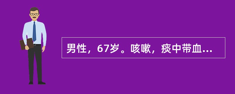 男性，67岁。咳嗽，痰中带血丝2个月，发热1Od，X线胸片显示右肺上叶片状阴影，