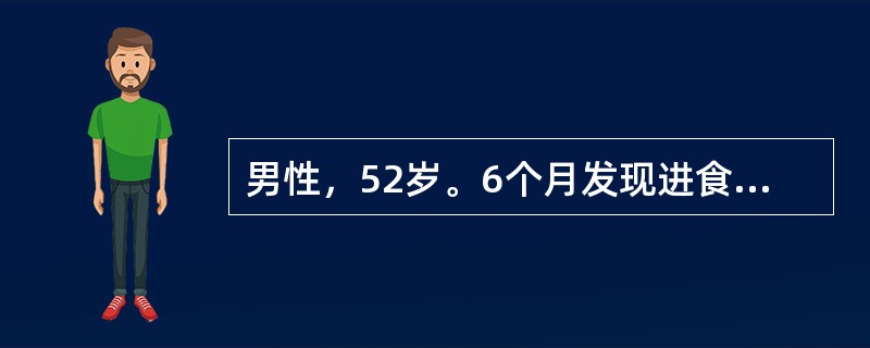 男性，52岁。6个月发现进食哽噎感，其后症状逐渐加重，近3周只能进全流质，体重减