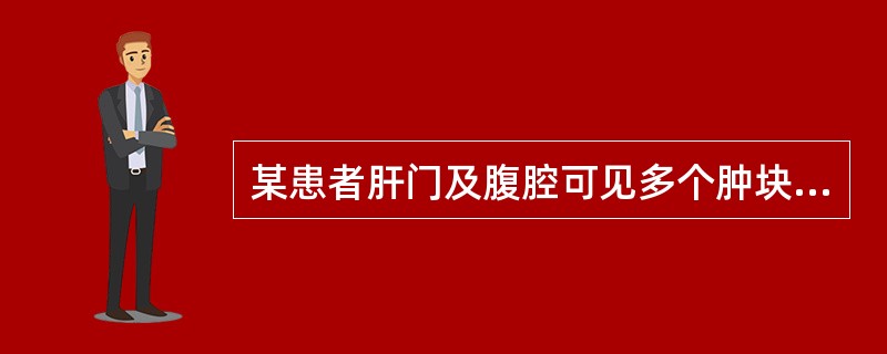 某患者肝门及腹腔可见多个肿块回声。根据声像图表现，最可能的诊断是（）