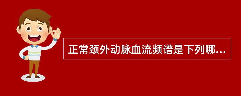 正常颈外动脉血流频谱是下列哪种形态（）