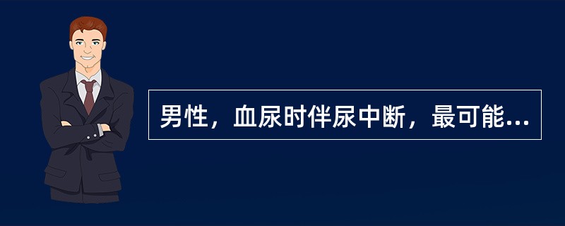 男性，血尿时伴尿中断，最可能的诊断为（）