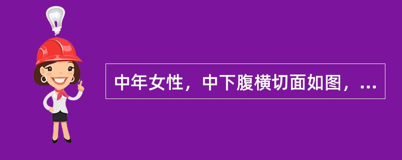 中年女性，中下腹横切面如图，箭头所示为（）