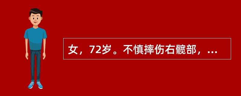 女，72岁。不慎摔伤右髋部，查体：右下肢短缩，外旋50°畸形，右髋肿胀不明显，但