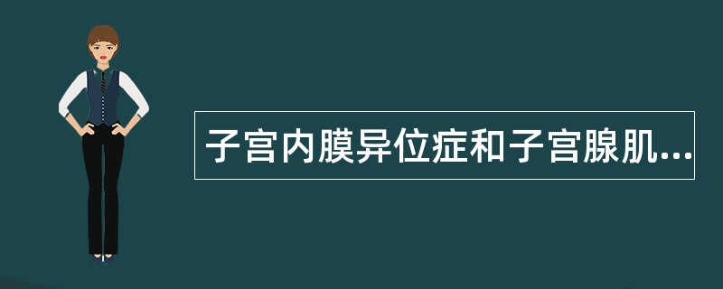 子宫内膜异位症和子宫腺肌病题库
