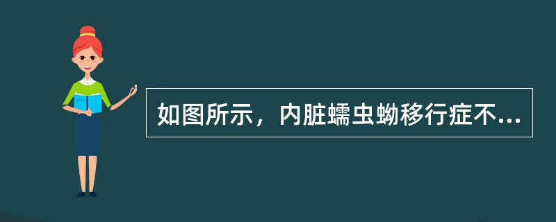 如图所示，内脏蠕虫蚴移行症不包括下列哪项()