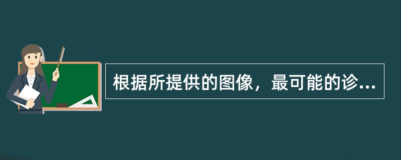 根据所提供的图像，最可能的诊断()