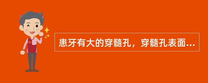 患牙有大的穿髓孔，穿髓孔表面为炎性渗出、食物残渣及坏死物覆盖，其下方为炎性肉芽组