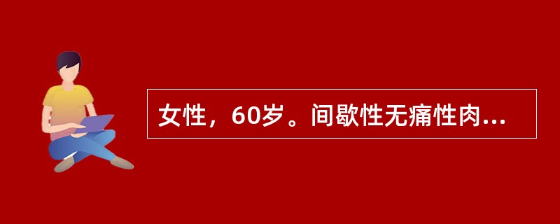 女性，60岁。间歇性无痛性肉眼全程血尿5个月，尿色为鲜红色，伴片状小血凝块。