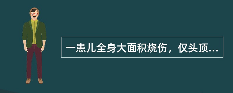 一患儿全身大面积烧伤，仅头顶及腰部约五掌面积未烧伤，则烧伤面积为（）