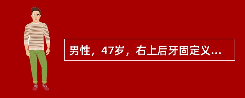 男性，47岁，右上后牙固定义齿修复半年后松动。查：6│缺失，余牙正常，57│全冠