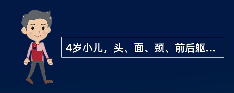 4岁小儿，头、面、颈、前后躯干烧伤，面积为（）.