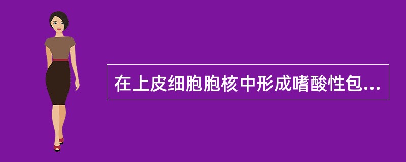 在上皮细胞胞核中形成嗜酸性包涵体呈“猫头鹰眼”样的病毒是()