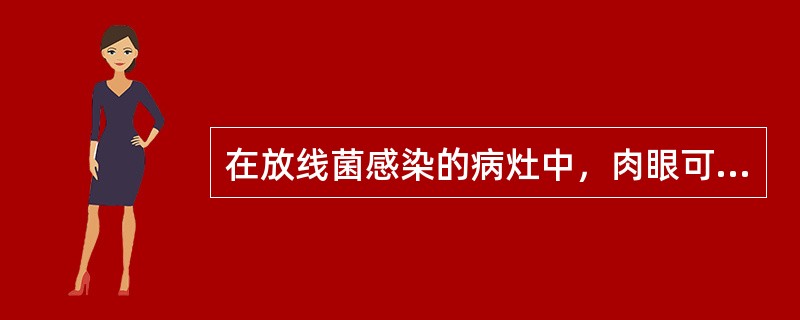 在放线菌感染的病灶中，肉眼可见硫磺颗粒，其实质是（）