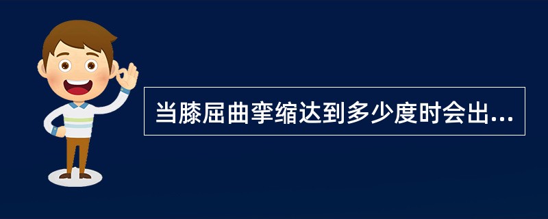 当膝屈曲挛缩达到多少度时会出现短腿步态（）