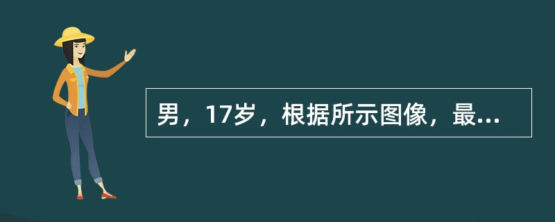 男，17岁，根据所示图像，最可能的诊断是（）