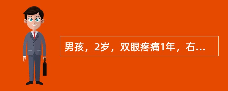 男孩，2岁，双眼疼痛1年，右侧眼球突出。CT平扫如图：本病最可能诊断为（）