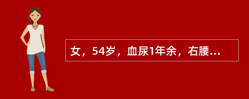 女，54岁，血尿1年余，右腰痛10天余，CT示右肾下极60mm×70mm肿块，突