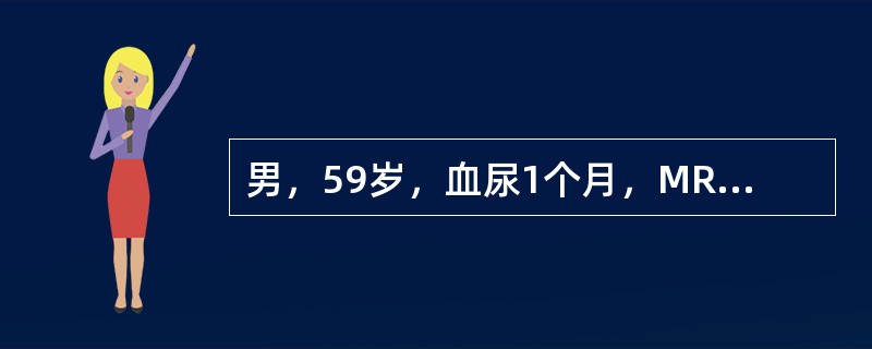 男，59岁，血尿1个月，MRI检查如图所示。最可能的诊断是（）