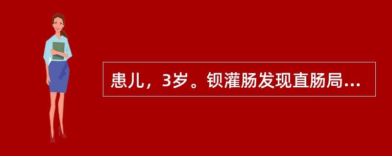 患儿，3岁。钡灌肠发现直肠局限性狭窄，近端肠管明显扩张。诊断应考虑为（）