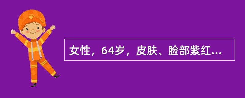 女性，64岁，皮肤、脸部紫红5月余，无心、肺疾病史。体检：脾肋下3cm，肝肋下1