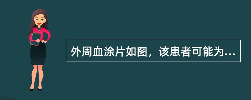 外周血涂片如图，该患者可能为下列何种疾病（）