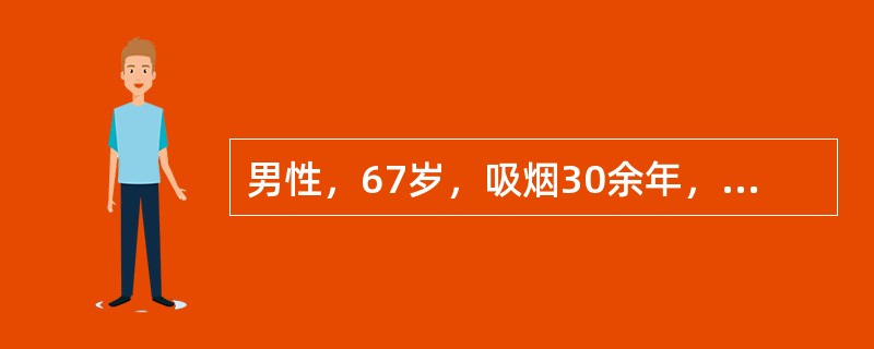 男性，67岁，吸烟30余年，每天20支，刺激性咳嗽3周，呈高调金属音，咳脓痰、发