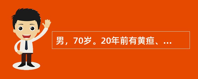 男，70岁。20年前有黄疸、食欲缺乏，诊断为肝炎。近2个月来食欲缺乏、消瘦，肝区