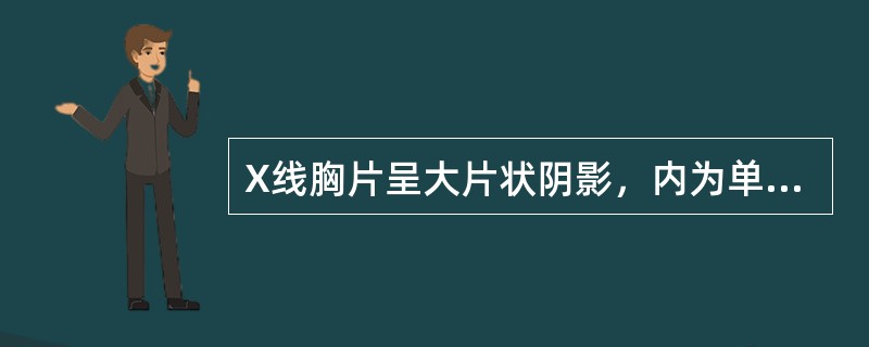 X线胸片呈大片状阴影，内为单个空洞伴液平（）